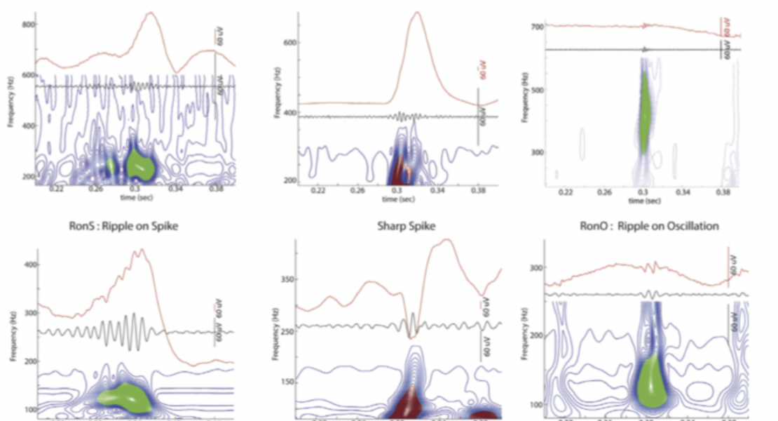 High frequency oscillations identified in iEEG data